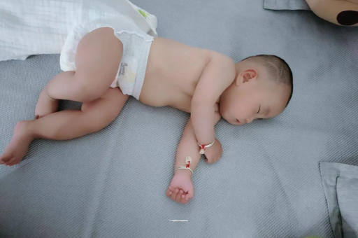仙桃六个月宝宝眼睛散光